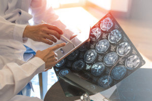 Physicians looking at a digital MRI of a brain scan to determine blood clots in the brain