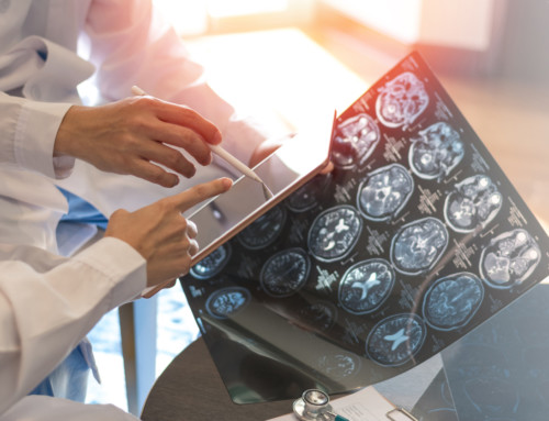 Tri-City Medical Center Integrates AI Technology in its Stroke Care Services Because “Time is Brain”